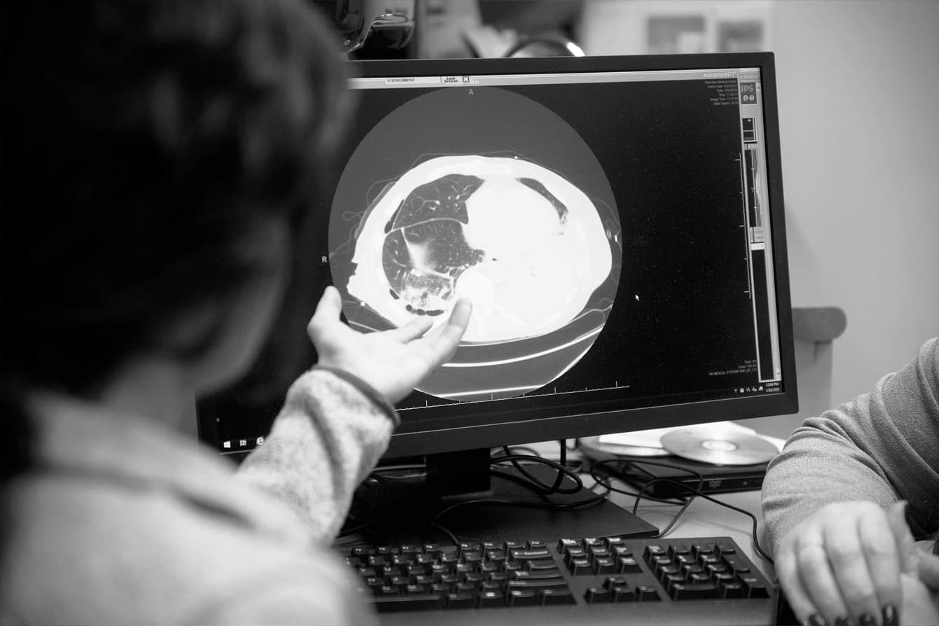 I’ve been diagnosed with lung cancer. What comes next?