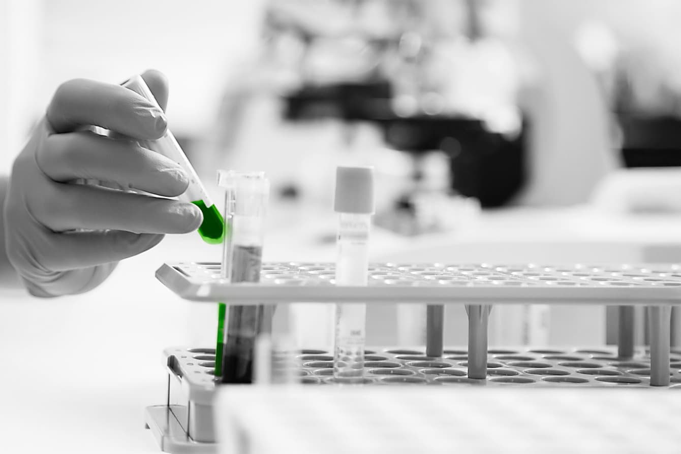 Application Note: Proteomic Profiling on Human Cerebral Spinal Fluid