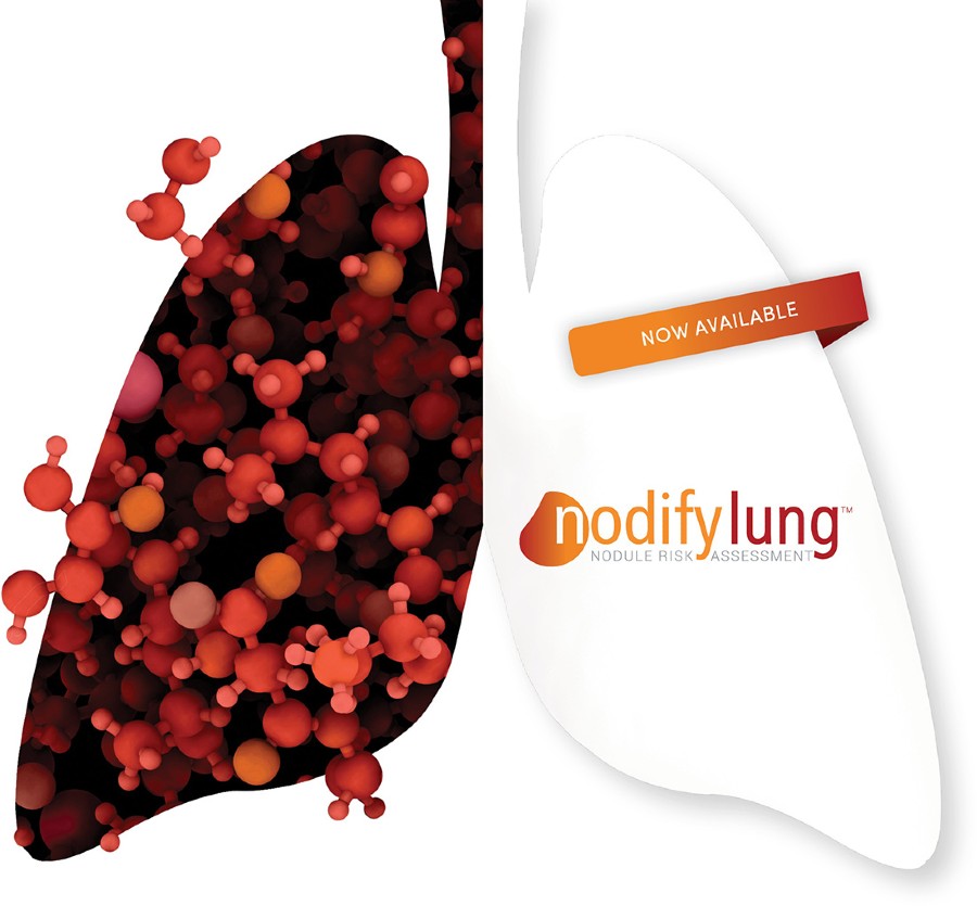 Nodify-Lung-Now-Available-900x835