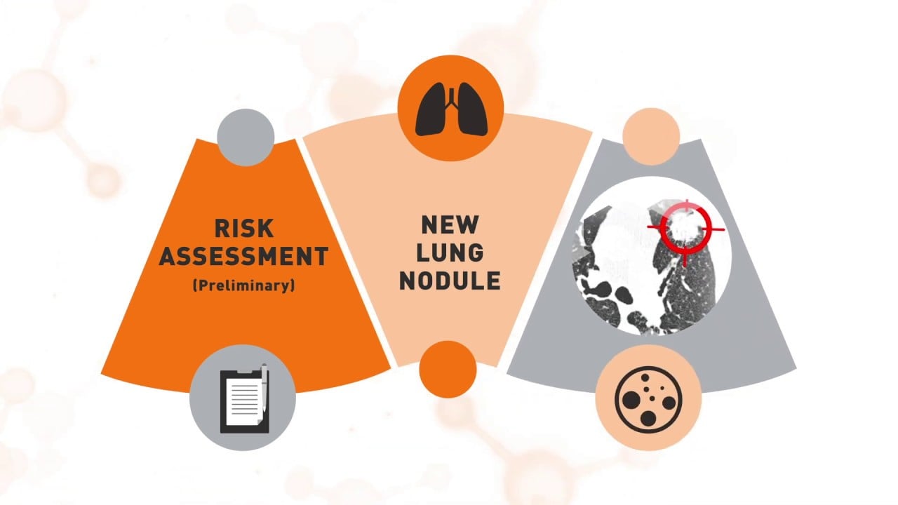 how does nodify lung testing work
